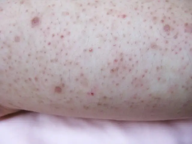 Jak pozbyć się kropek po goleniu i cieszyć się gładką skórą
