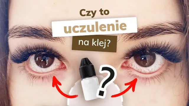 Alergia na klej do rzęs: Objawy, leczenie i co robić krok po kroku