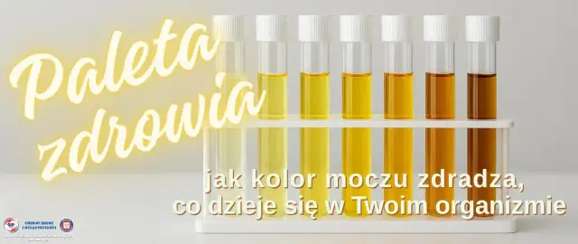 Paleta zdrowia: od jasnego do ciemnego moczu. Bardzo żółty mocz może sygnalizować zapalenie pęcherza.