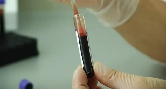 Czy leki na HIV są refundowane? Sprawdź, co musisz wiedzieć o dostępności