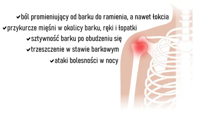 Ból barku, sztywność, trzeszczenie w stawie barkowym. Widoczna głowa kości ramiennej z zaczerwienieniem.