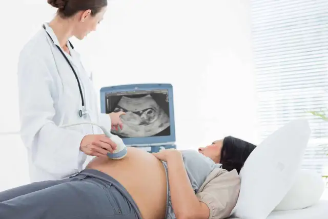 Harmonogram badań prenatalnych: Kiedy i dlaczego je wykonać?