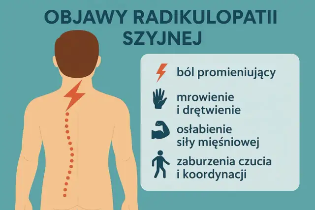 Ilustracja pokazuje objawy radikulopatii szyjnej: ból promieniujący, mrowienie, drętwienie, osłabienie mięśni i zaburzenia czucia. Odczuwasz ucisk w szyi? To może być jeden z objawów.