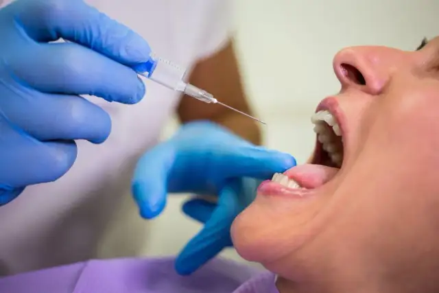 Alkohol po dentyscie: kiedy można pić? Sprawdź zalecenia