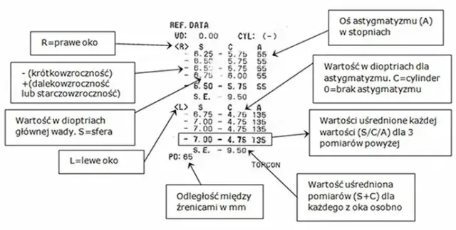 Jak czytać wyniki badania wzroku u okulisty i uniknąć błędów