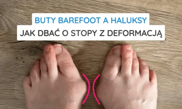 Jak zapobiec haluksom? Porady eksperta dla Twoich zdrowych stóp.
