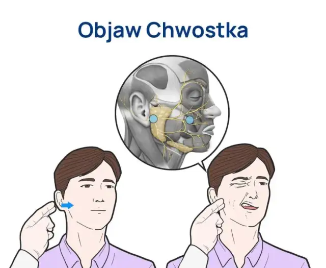 Tężyczka a nerwica: objawy psychiczne, diagnoza i leczenie