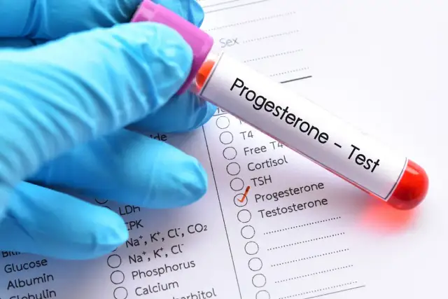 Rękawiczka trzyma probówkę z napisem "Progesteron - Test". Obok zaznaczono "Progesteron" na liście badań. Czy progesteron trzeba badać na czczo?