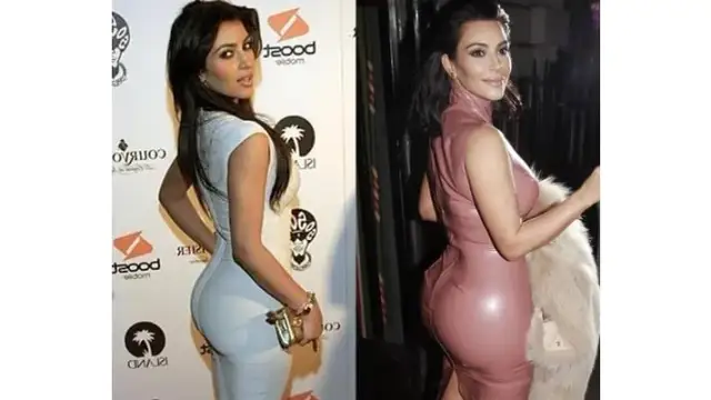 Kim Kardashian: Prawda o operacjach plastycznych i "efekcie BBL"