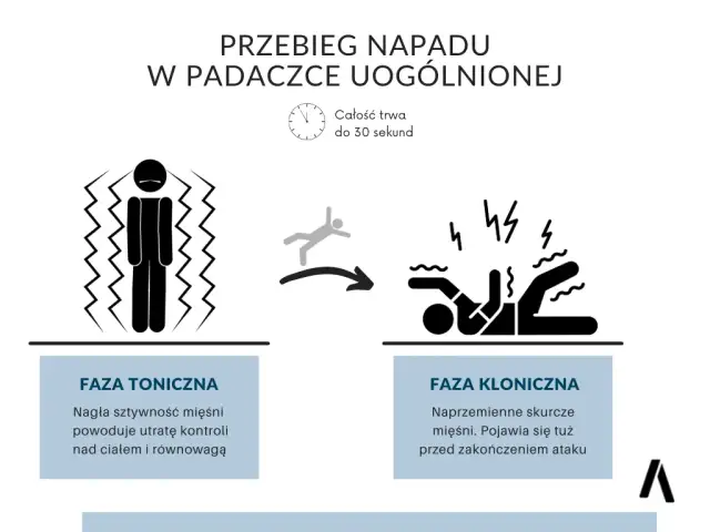 Padaczka: objawy, pierwsza pomoc i kluczowe informacje, które ratują życie