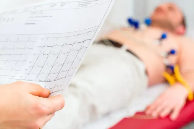 EKG spoczynkowe: Co wykryje, a czego nie? Pełna prawda o sercu