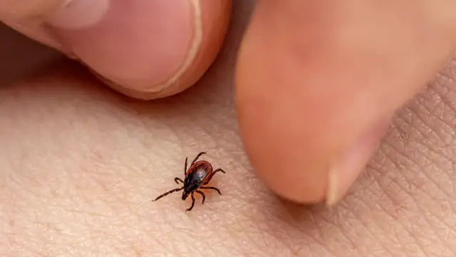 Cómo extraer una garrapata de forma segura y evitar enfermedades