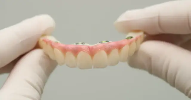 Dłonie w rękawiczkach trzymają protezę zębową na implantach. Dofinansowanie do protezy zębowej może pomóc w odzyskaniu pięknego uśmiechu.
