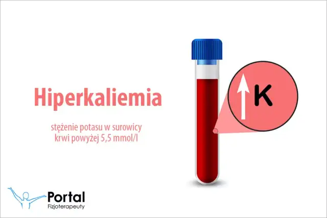 Podwyższony potas (hiperkaliemia): przyczyny, objawy i jak obniżyć?