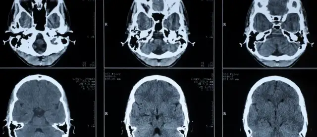 Die Bedeutung der medizinischen Diagnostik für präzise Krankheitsdiagnosen