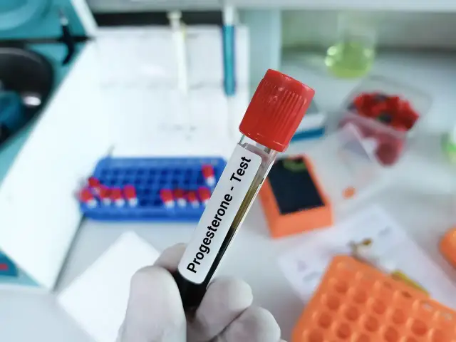 Probówka z napisem "Progesterone - Test" w laboratorium. Badanie progesteronu u kobiet jest kluczowe w diagnostyce cyklu miesiączkowego i ciąży.