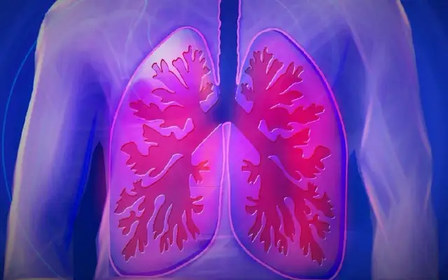 Fibrosis quística: quién la descubrió y el impacto de su hallazgo