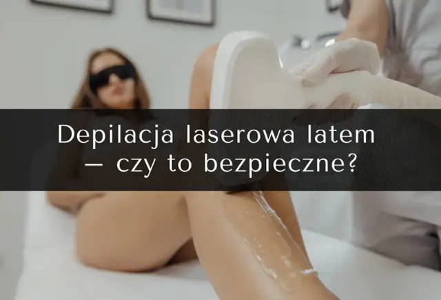 Kobieta w okularach ochronnych podczas depilacji laserowej. Czy po depilacji laserowej można się opalać?