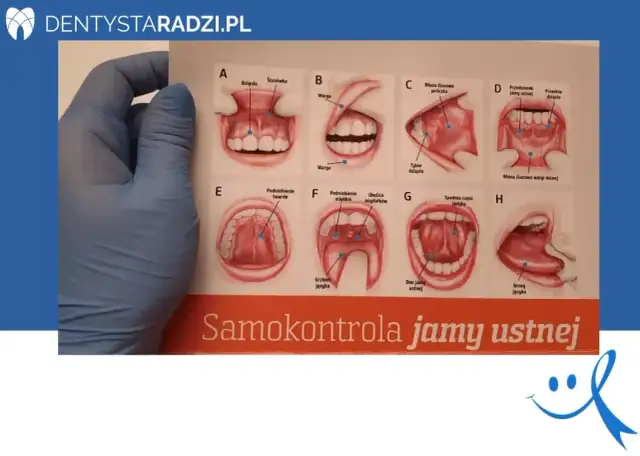 Rak dziąseł: objawy. Czy Twoje dziąsła mówią Ci coś ważnego?