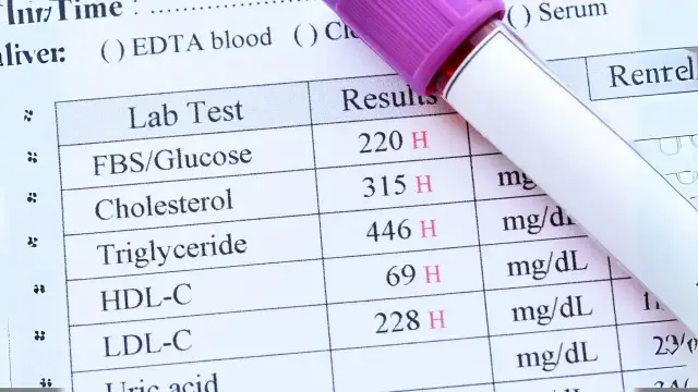Wyniki badań krwi: glukoza, cholesterol, trójglicerydy, HDL-C, LDL-C. Szybko uzyskane dane do analizy.
