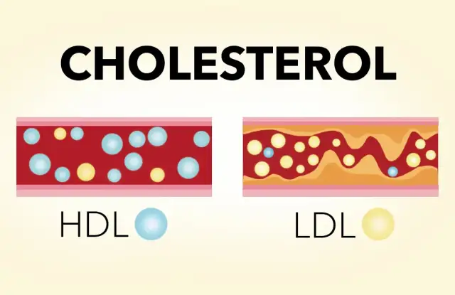 Jak obniżyć cholesterol przy izoteku i uniknąć zdrowotnych zagrożeń
