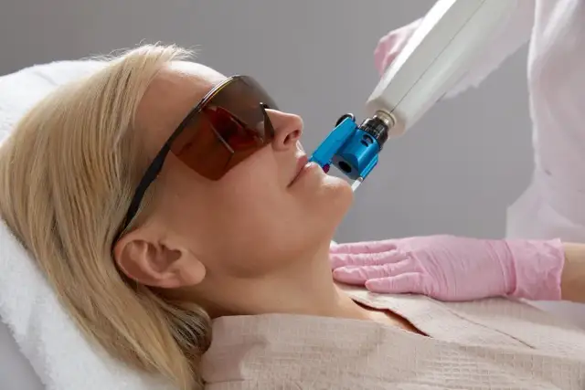 Regeneracja po laserze frakcyjnym: Przewodnik krok po kroku
