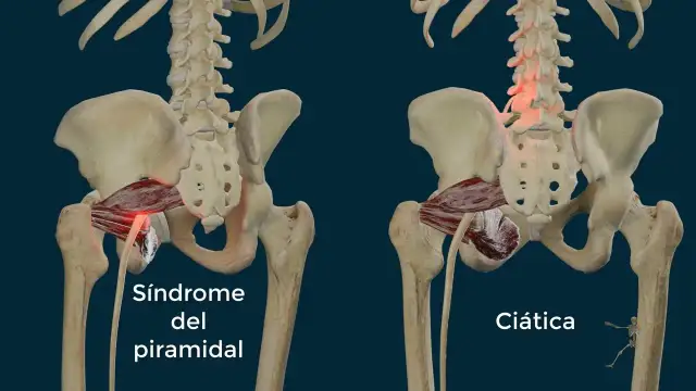 Músculos piramidales: diferencias clave entre piriforme y piramidal