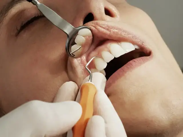 Ile trwa wizyta u dentysty? Czas zabiegów od A do Z