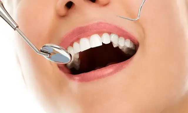 Jak wyleczyć próchnicę bez dentysty? Prawda o domowej remineralizacji.