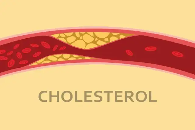 Czy cholesterol jest produkowany w skórze? Odkryj jego znaczenie dla zdrowia