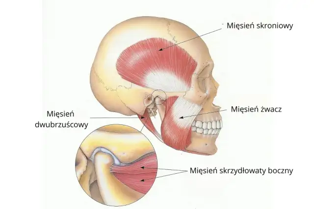 Anatomia mięśni żucia, kluczowa dla zrozumienia i leczenia bocznego przemieszczenia żuchwy.