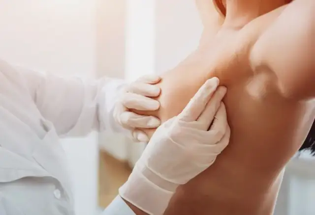 Co na torbiele w piersiach? Spokój, diagnoza i skuteczne metody.