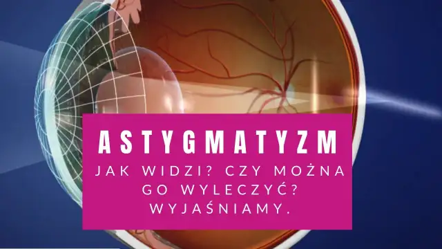 Grafika przedstawia przekrój oka z widocznymi naczyniami krwionośnymi siatkówki. Na różowym tle napis "ASTYGMATYZM".
