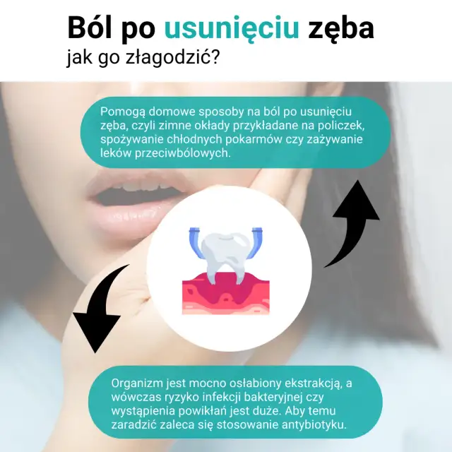 Jak długo boli po usunięciu zęba i jak złagodzić nieprzyjemne dolegliwości