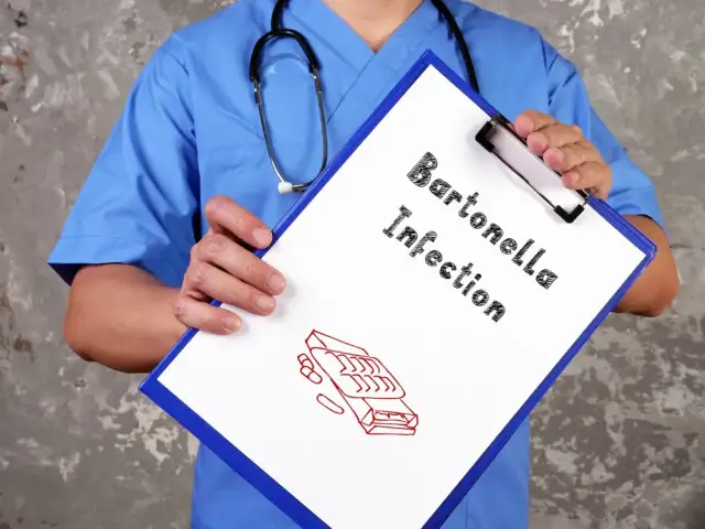 Bartonella objawy psychiczne: niebezpieczne skutki, które musisz znać
