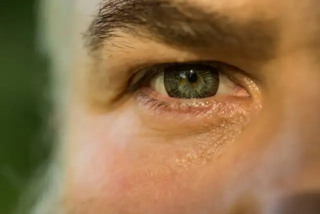 Jak leczyć zaćmę skutecznie? Poznaj najlepsze metody i operację