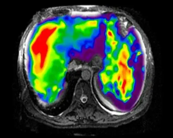 Rezonans magnetyczny NFZ w Lublinie - gdzie najszybciej i bez czekania