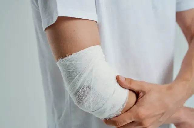 Kiedy zacząć rehabilitację po złamaniu kości ramiennej? Pełny poradnik