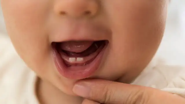 Ból gardła u niemowlaka: Rozpoznaj objawy i bezpiecznie pomóż maluszkowi