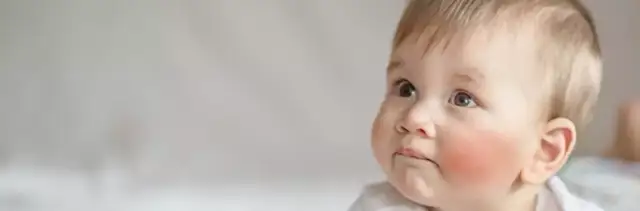 Jak skutecznie zbić wysoką gorączkę u dziecka: 10 sprawdzonych metod