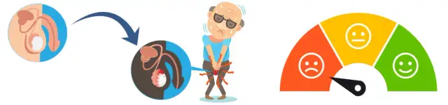 Jak złagodzić ból jąder? Skuteczne metody i ważne informacje