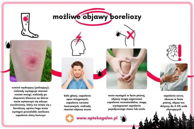 Objawy psychiczne neuroboreliozy: Jak rozpoznać i skutecznie leczyć?