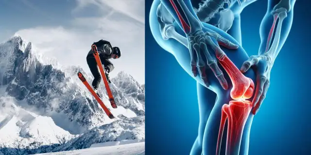 Skręcenie kolana - Co może zobrazować rezonans magnetyczny stawu kolanowego?