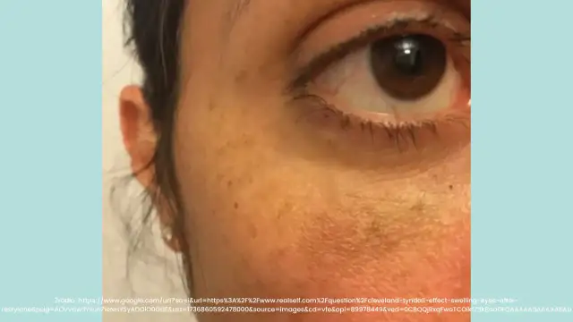 Kwas hialuronowy w tabletkach: Jak nie popełnić błędu przy wyborze?