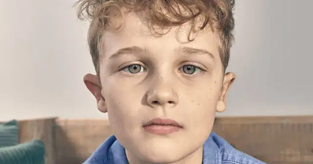 Czy zez jest wyleczalny? Sprawdź skuteczne metody leczenia!