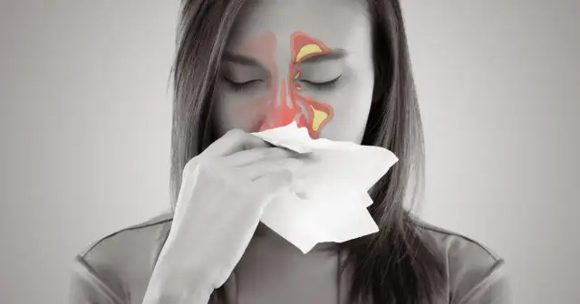 Do jakiego lekarza z zatokami udać się, by uniknąć bólu?