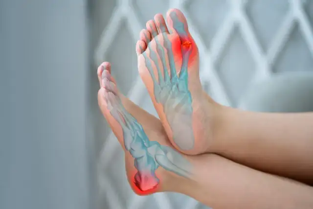 Dna moczanowa: przyczyny. Zrozum źródło, odzyskaj kontrolę!