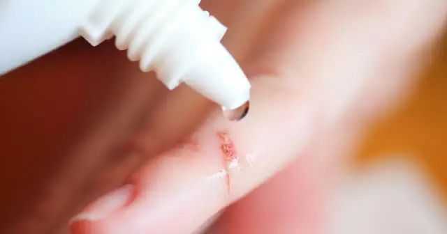 Woda utleniona w apteczce: wyrzucić czy zostawić? Prawda o ranach