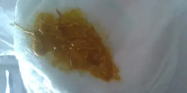 Śluz w kupie niemowlaka: co oznacza i kiedy to niepokojący objaw?