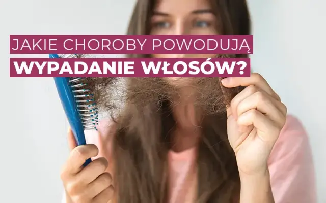 Wypadanie włosów jakie badania? Sprawdź, co może je powodować